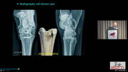 thumbnail for The Distal Hindlimb up to PSL 2026